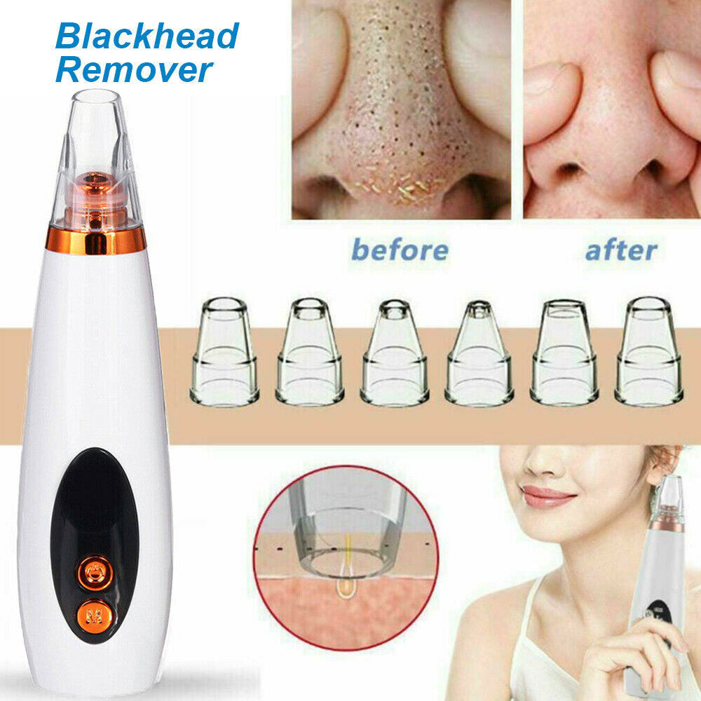 Electric Blackhead Remover | Vacuum Acne & Pore Cleaner | 5 Heads Suction Machine | Skin Care & Exfoliating Tool