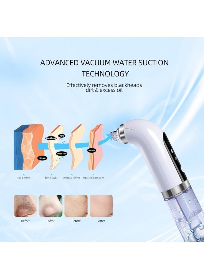 Electric Blackhead Remover | Vacuum Acne & Pore Cleaner | 5 Heads Suction Machine | Skin Care & Exfoliating Tool